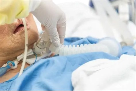 Special Valve on Medical Respirator